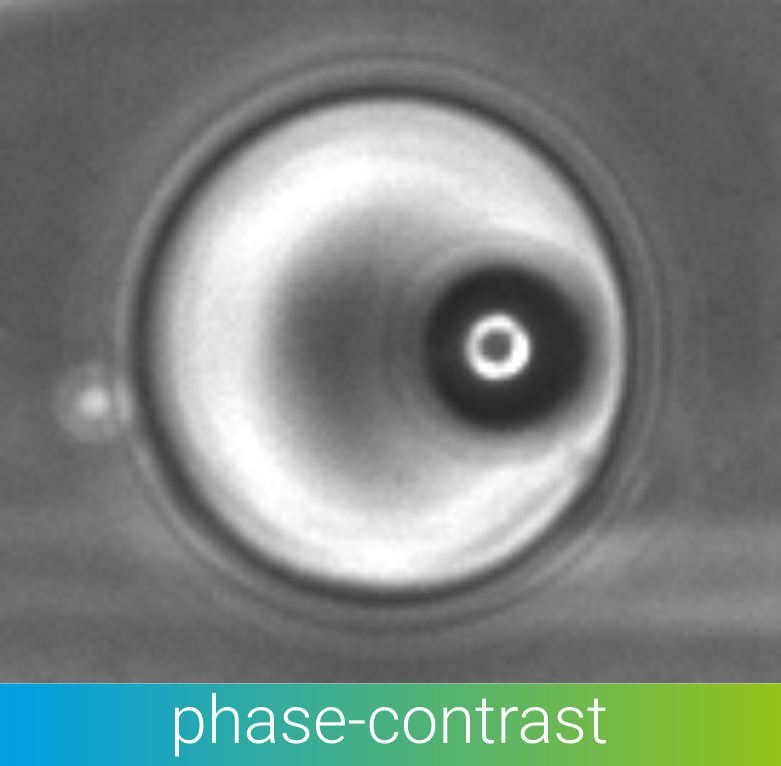 bead in droplet in phase-contrast
